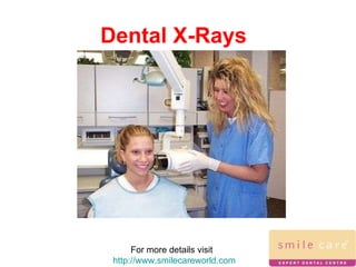 Dental X-Rays For more details visit  http://www.smilecareworld.com 