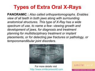 For more details visit  http://www.smilecareworld.com Types of Extra Oral X-Rays PANORAMIC :  Also called orthopantomographs. Enables view of all teeth in both jaws along with surrounding anatomical structures. This type of X-Ray has a wide spectrum of use, to name a few- viewing growth and development of jaws, for diagnosis and treatment planning for multidisciplinary treatment or implant placements, or for detecting jaw fractures or pathology, or temporomandibular joint disorders. 