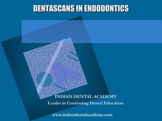 DENTASCANS IN ENDODONTICS




      INDIAN DENTAL ACADEMY
   Leader in Continuing Dental Education

     www.indiandentalacademy.com
 