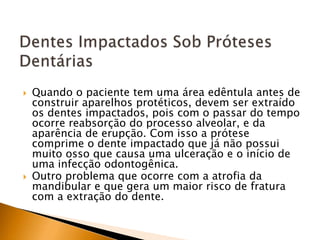  Quando o paciente tem uma área edêntula antes de
construir aparelhos protéticos, devem ser extraído
os dentes impactados, pois com o passar do tempo
ocorre reabsorção do processo alveolar, e da
aparência de erupção. Com isso a prótese
comprime o dente impactado que já não possui
muito osso que causa uma ulceração e o início de
uma infecção odontogênica.
 Outro problema que ocorre com a atrofia da
mandibular e que gera um maior risco de fratura
com a extração do dente.
 
