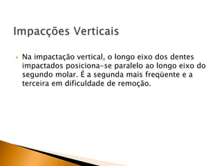  Na impactação vertical, o longo eixo dos dentes
impactados posiciona-se paralelo ao longo eixo do
segundo molar. É a segunda mais freqüente e a
terceira em dificuldade de remoção.
 