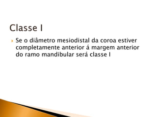  Se o diâmetro mesiodistal da coroa estiver
completamente anterior á margem anterior
do ramo mandibular será classe I
 