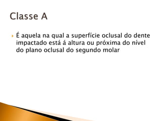 É aquela na qual a superfície oclusal do dente
impactado está á altura ou próxima do nível
do plano oclusal do segundo molar
 