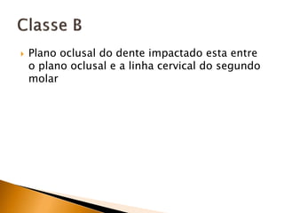 Plano oclusal do dente impactado esta entre
o plano oclusal e a linha cervical do segundo
molar
 