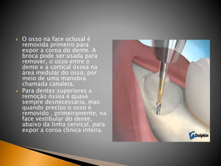  O osso na face oclusal é
removida primeiro para
expor a coroa do dente. A
broca pode ser usada para
remover, o osso entre o
dente e a cortical óssea na
área medular do osso, por
meio de uma manobra
chamada canaleta.
 Para dentes superiores a
remoção óssea é quase
sempre desnecessária, mas
quando preciso o osso é
removido , primeiramente, na
face vestibular do dente,
abaixo da linha cervical, para
expor a coroa clinica inteira.
 