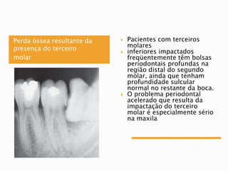 Perda óssea resultante da
presença do terceiro
molar
 Pacientes com terceiros
molares
 inferiores impactados
freqüentemente têm bolsas
periodontais profundas na
região distal do segundo
molar, ainda que tenham
profundidade sulcular
normal no restante da boca.
 O problema periodontal
acelerado que resulta da
impactação do terceiro
molar é especialmente sério
na maxila.
 
