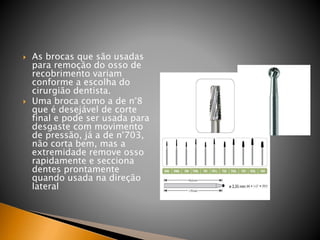  As brocas que são usadas
para remoção do osso de
recobrimento variam
conforme a escolha do
cirurgião dentista.
 Uma broca como a de n°8
que é desejável de corte
final e pode ser usada para
desgaste com movimento
de pressão, já a de n°703,
não corta bem, mas a
extremidade remove osso
rapidamente e secciona
dentes prontamente
quando usada na direção
lateral
 