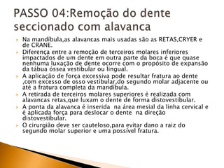  Na mandíbula,as alavancas mais usadas são as RETAS,CRYER e
de CRANE.
 Diferença entre a remoção de terceiros molares inferiores
impactados de um dente em outra parte da boca é que quase
nenhuma luxação de dente ocorre com o propósito de expansão
da tábua óssea vestibular ou lingual.
 A aplicação de força excessiva pode resultar fratura ao dente
,com excesso de osso vestibular,do segundo molar adjacente ou
até a fratura completa da mandíbula.
 A retirada de terceiros molares superiores é realizada com
alavancas retas,que luxam o dente de forma distovestibular.
 A ponta da alavanca é inserida na área mesial da linha cervical e
é aplicada força para deslocar o dente na direção
distovestibular.
 O cirurgião deve ser cauteloso,para evitar dano a raiz do
segundo molar superior e uma possível fratura.
 