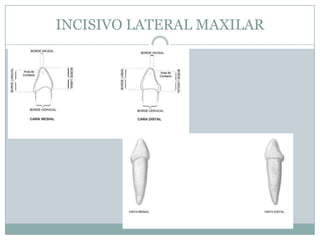 INCISIVO LATERAL MAXILAR
 