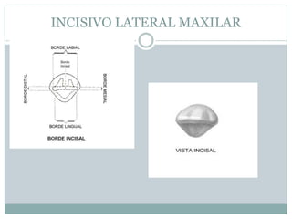 INCISIVO LATERAL MAXILAR
 