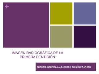 +
IMAGEN RADIOGRÁFICA DE LA
PRIMERA DENTICIÓN
CDEOOM. GABRIELA ALEJANDRA GONZÁLEZ ARCEO
 