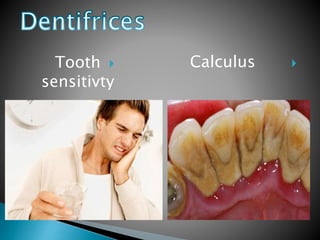 Tooth
sensitivty
Calculus
 