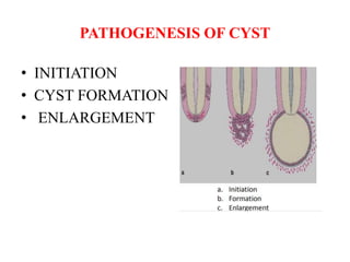 Dentigerous cyst | PPTX