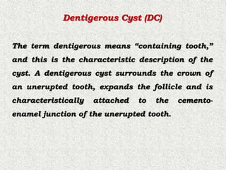 Dentigerous Cyst.ppt