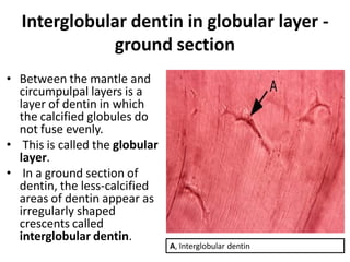 Dentin | PPT