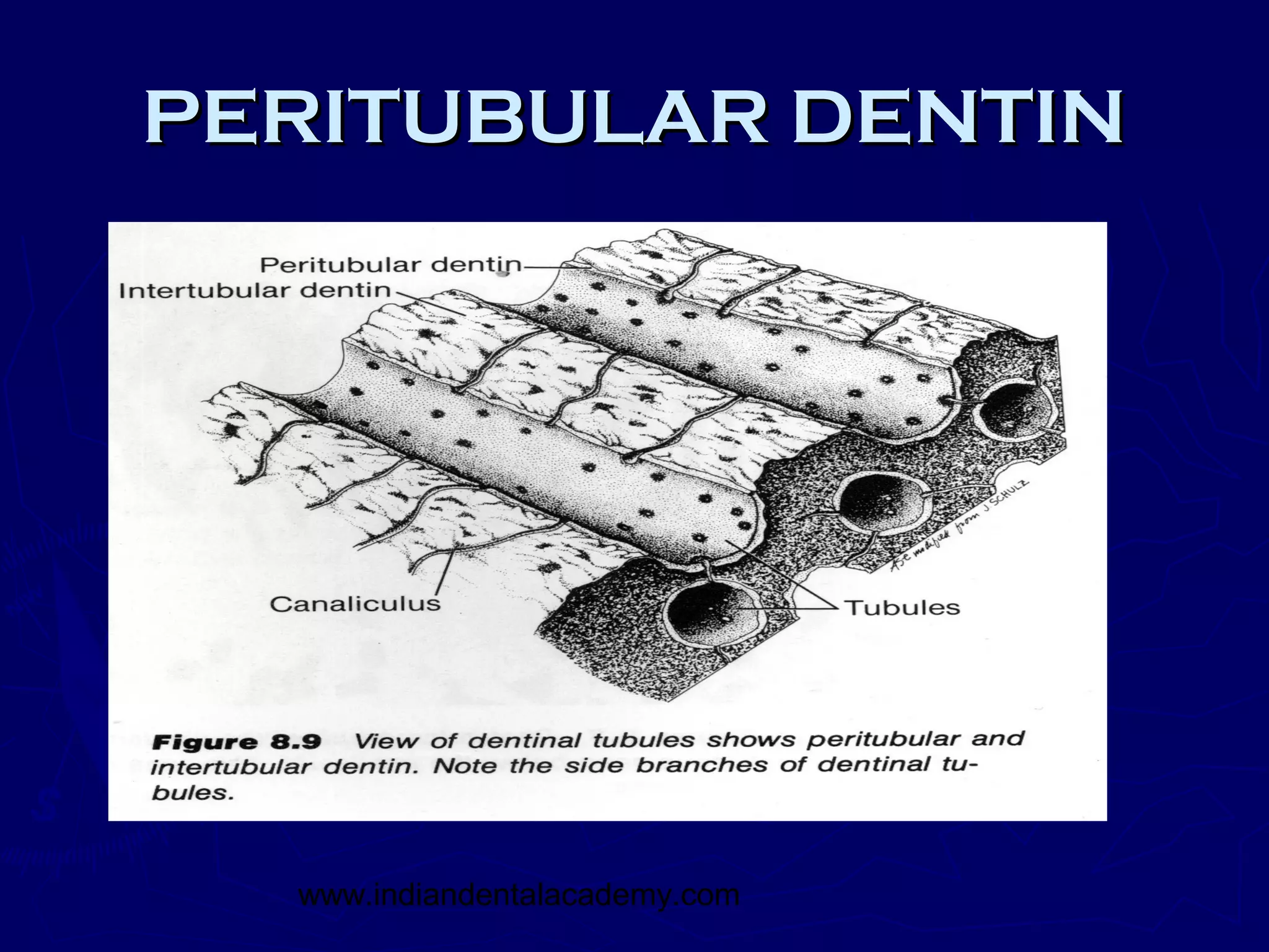 PERITUBULAR DENTIN




  www.indiandentalacademy.com
 