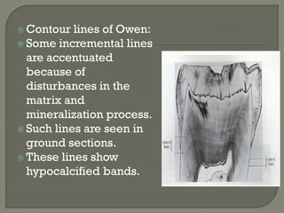  Contour lines of Owen:
 Some incremental lines
are accentuated
because of
disturbances in the
matrix and
mineralization process.
 Such lines are seen in
ground sections.
 These lines show
hypocalcified bands.
 