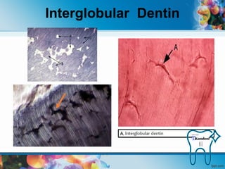 Dentin | PDF