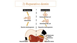 DENTIN.pptx