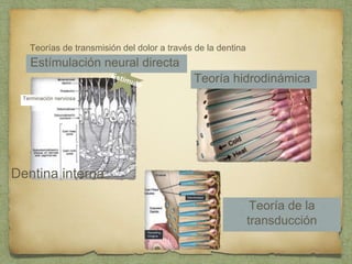 Teorías de transmisión del dolor a través de la dentina
Terminación nerviosa
Estímulación neural directa
Dentina interna
Teoría hidrodinámica
Teoría de la
transducción
 