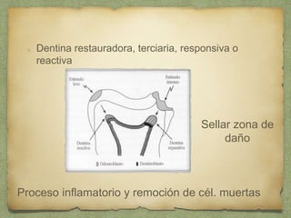 Dentina restauradora, terciaria, responsiva o
reactiva
Sellar zona de
daño
Proceso inflamatorio y remoción de cél. muertas
 