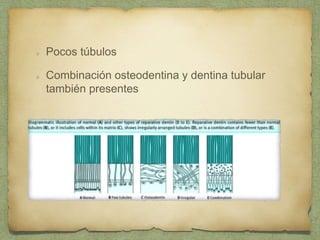 Pocos túbulos
Combinación osteodentina y dentina tubular
también presentes
 