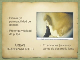 Disminuye
permeabilidad de
dentina
Prolonga vitalidad
de pulpa
En ancianos (raíces) y
caries de desarrollo lento
ÁREAS
TRANSPARENTES
 