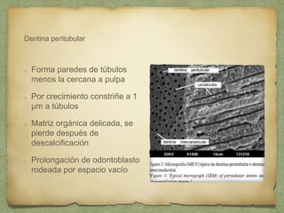 Dentina peritubular
Forma paredes de túbulos
menos la cercana a pulpa
Por crecimiento constriñe a 1
µm a túbulos
Matriz orgánica delicada, se
pierde después de
descalcificación
Prolongación de odontoblasto
rodeada por espacio vacío
 