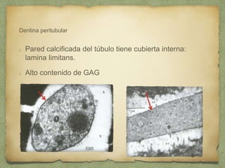 Dentina peritubular
Pared calcificada del túbulo tiene cubierta interna:
lamina limitans.
Alto contenido de GAG
 