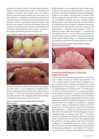 Dentinalhypersensitivity | PDF