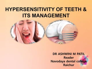 HYPERSENSITIVITY OF TEETH &
ITS MANAGEMENT
DR ASHWINI M PATIL
Reader
Navodaya dental college
Raichur
 