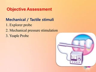 Objective Assessment
Mechanical / Tactile stimuli
1. Explorer probe
2. Mechanical pressure stimulation
3. Yeaple Probe
 