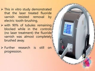  This in vitro study demonstrated
that the laser treated fluoride
varnish resisted removal by
electric tooth-brushing,
 with 90% of tubules remaining
blocked while in the controls
(no laser treatment) the fluoride
varnish was almost completely
brushed away.
 Further research is still on
progression.
 