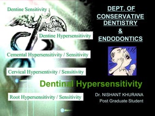 Dentinal hypersensitivity | PPTX