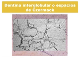 Dentina y dentinogénesis | PDF