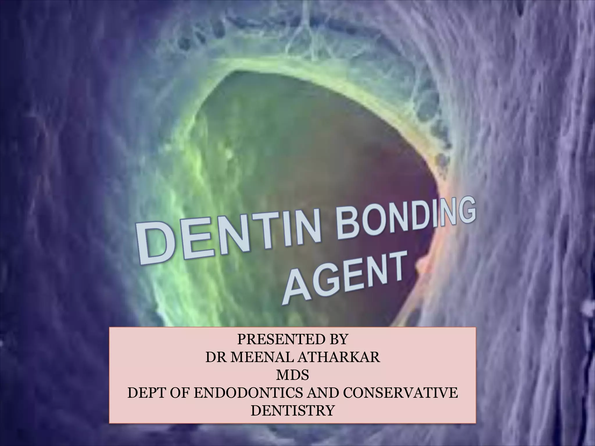 Dentin bonding agent PPT