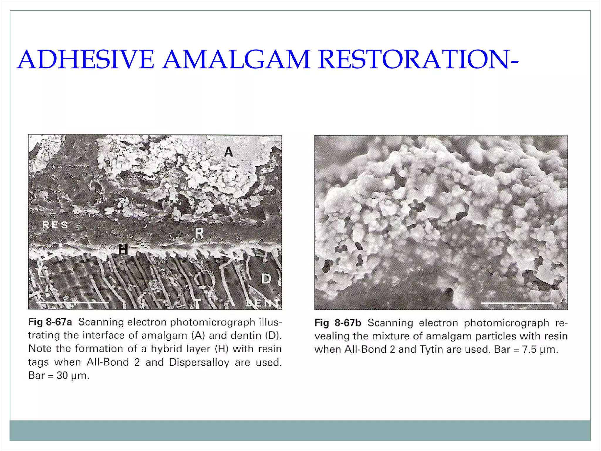 Dentin bonding agent
