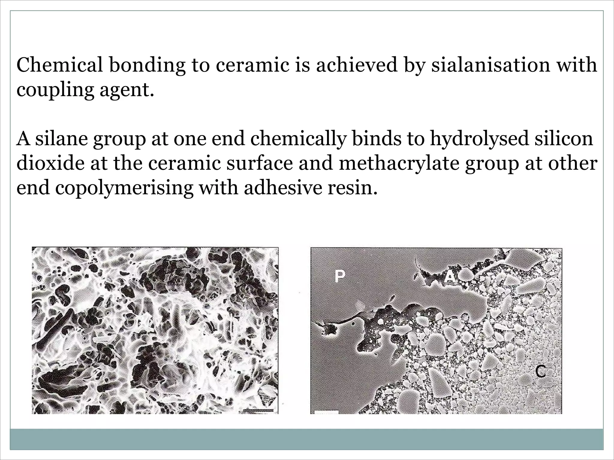 Dentin bonding agent