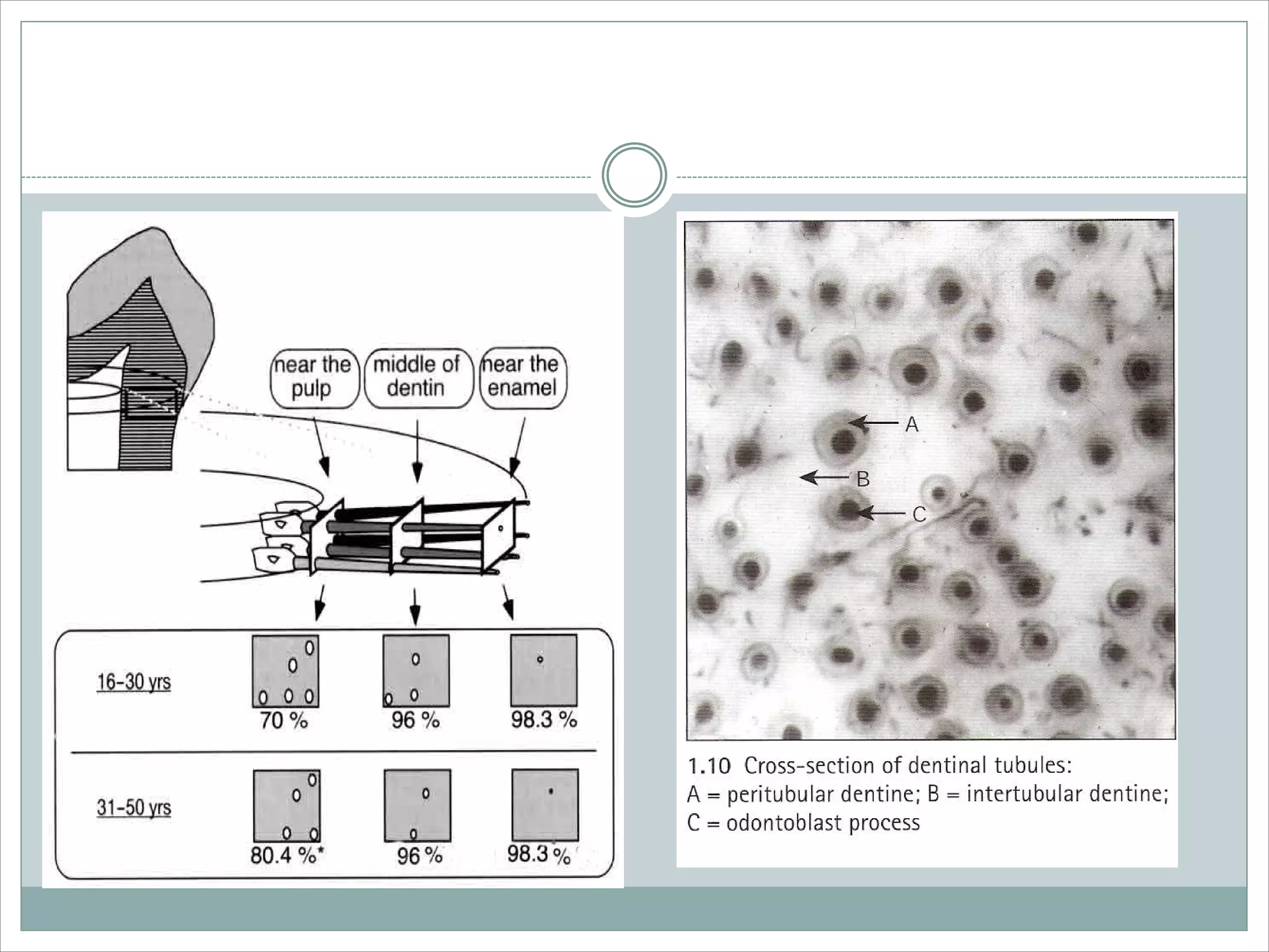 Dentin bonding agent