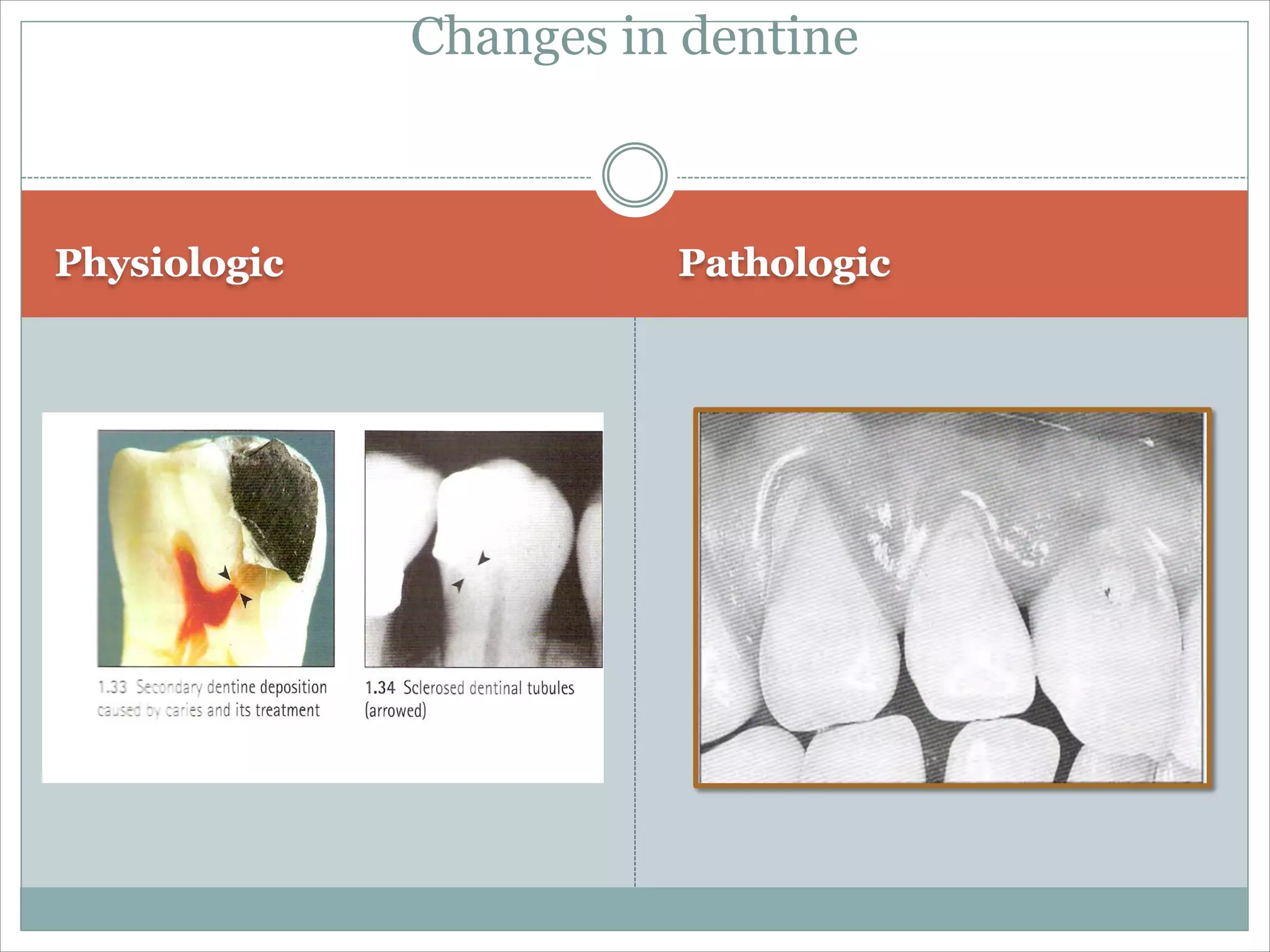 Dentin bonding agent
