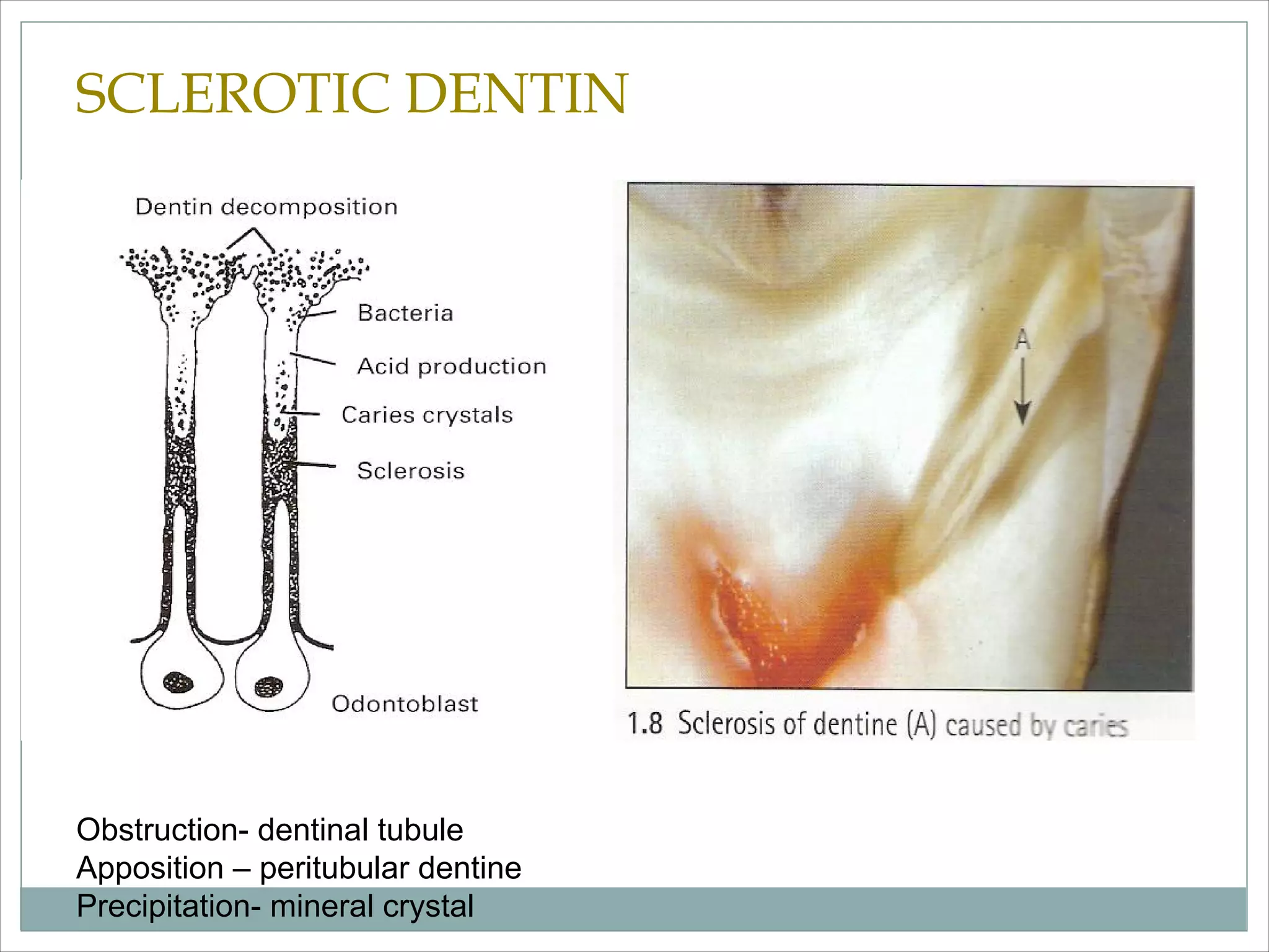 Dentin bonding agent