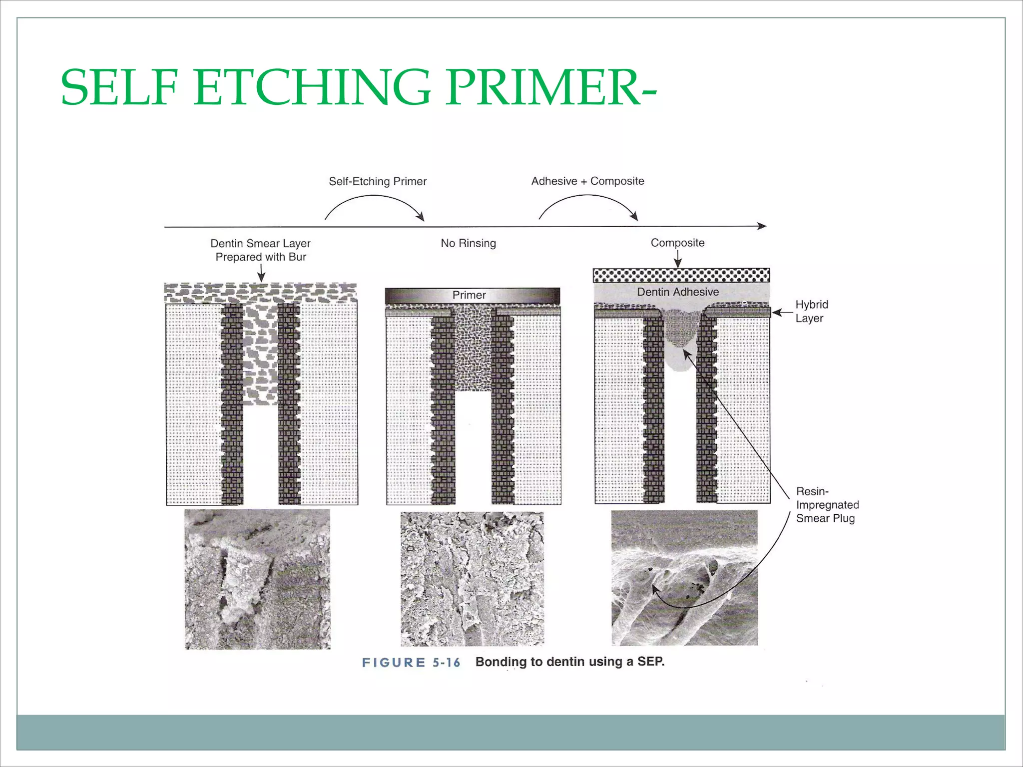 Dentin bonding agent