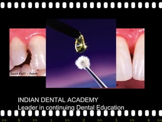 >> 0 >> 1 >> 2 >> 3 >> 4 >>
INDIAN DENTAL ACADEMY
Leader in continuing Dental Education
 