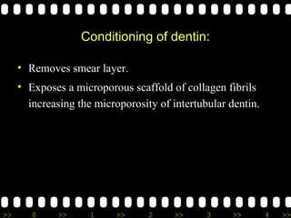 Dentin bonding agents final/cosmetic dentistry courses