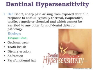 Sharp Linear Defect Tooth Dentin development | PPTX