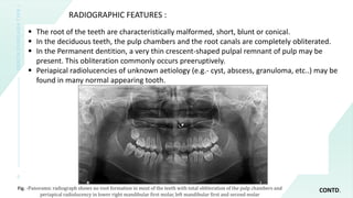 Dentin dysplasia PPT