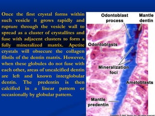 Once the first crystal forms within
such vesicle it grows rapidly and
rupture through the vesicle wall to
spread as a cluster of crystallites and
fuse with adjacent clusters to form a
fully mineralized matrix. Apetite
crystals will obsecure the collagen
fibrils of the dentin matrix. However,
when these globules do not fuse with
each other, areas of uncalcified dentin
are left and known interglobular
dentin. The predentin is then
calcified in a linear pattern or
occasionally by globular pattern.
 