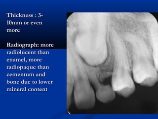 Thickness : 3-Thickness : 3-
10mm or even10mm or even
moremore
Radiograph: moreRadiograph: more
radiolucent thanradiolucent than
enamel, moreenamel, more
radiopaque thanradiopaque than
cementum andcementum and
bone due to lowerbone due to lower
mineral contentmineral content
 