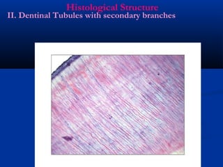Histological Structure
II. Dentinal Tubules with secondary branches
 