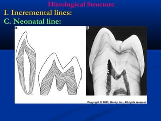 Histological Structure
I. Incremental lines:
C. Neonatal line:
 